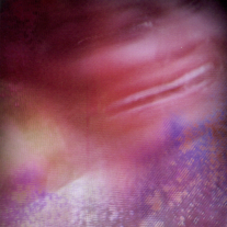 Brain_20candy_medium